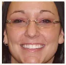 Adeena - Patient at Orillia Smile Centre